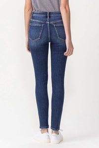 Entity Lovervet Skinny Jeans
